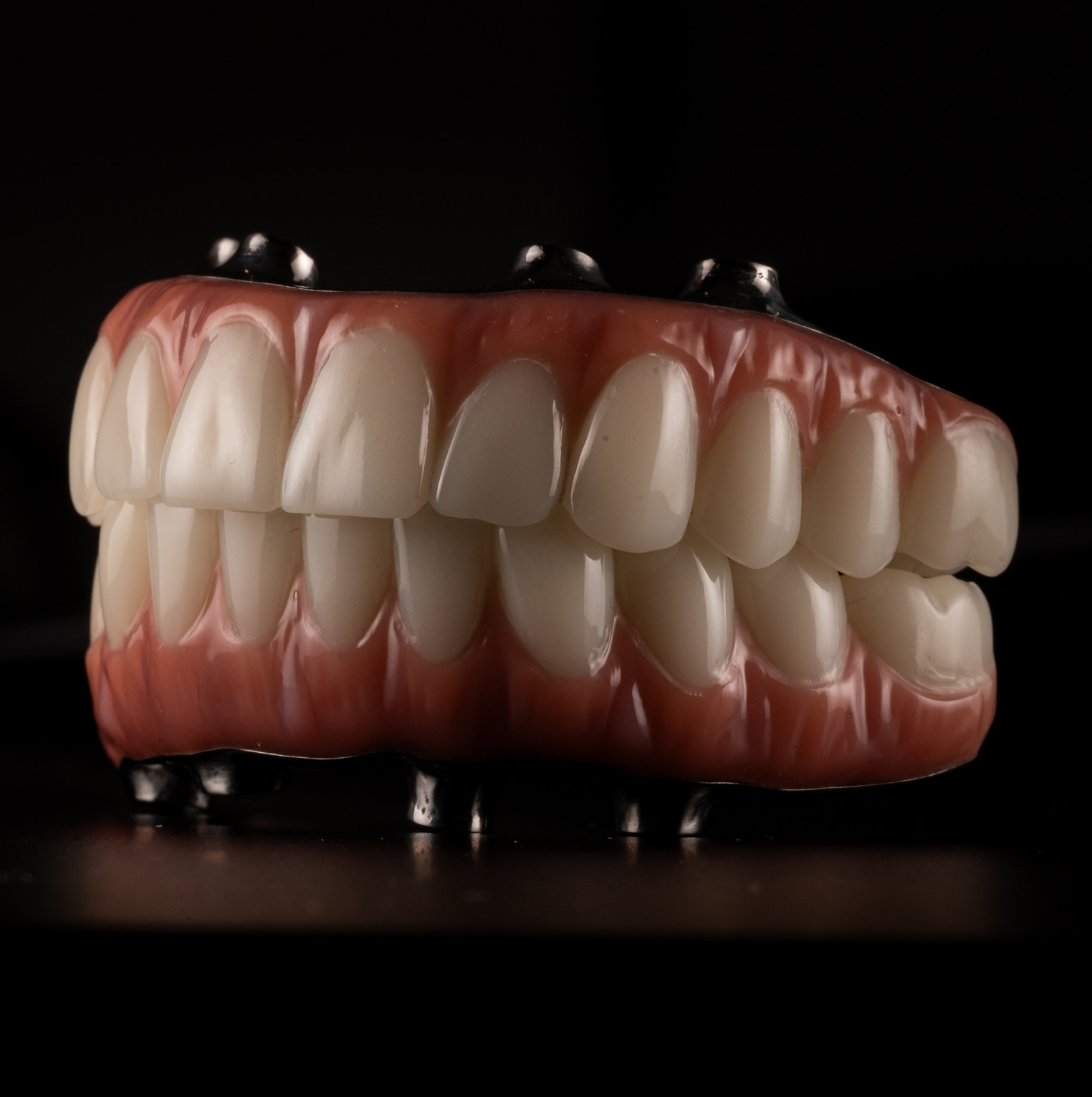 Full Arch Restoration